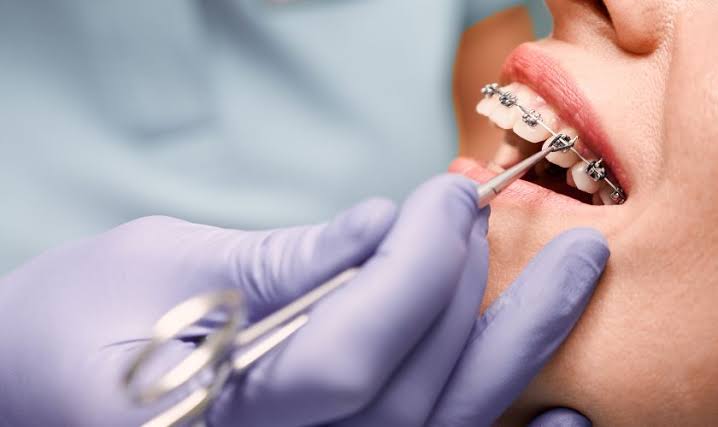 Understanding The Role Of A General Dentist In Orthodontics