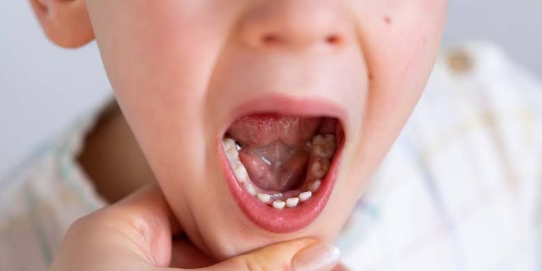 Pediatric Dentistry: A Closer Look At Dental Sealants For Children