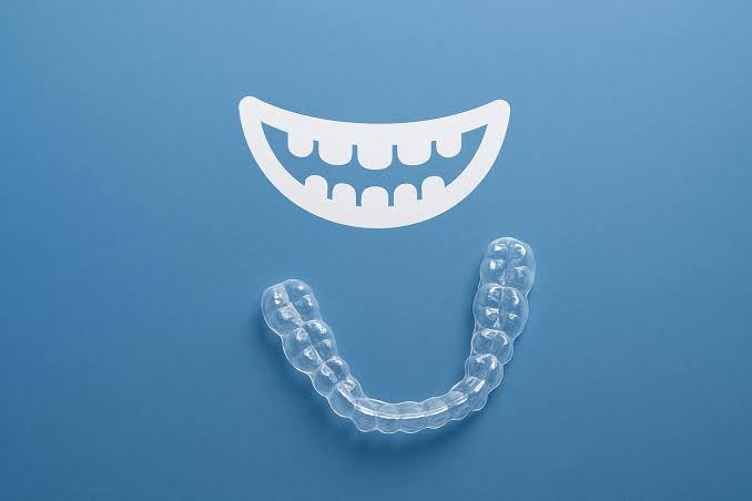 How Tidal Aligners Help Patients Maintain Confidence While Smiling