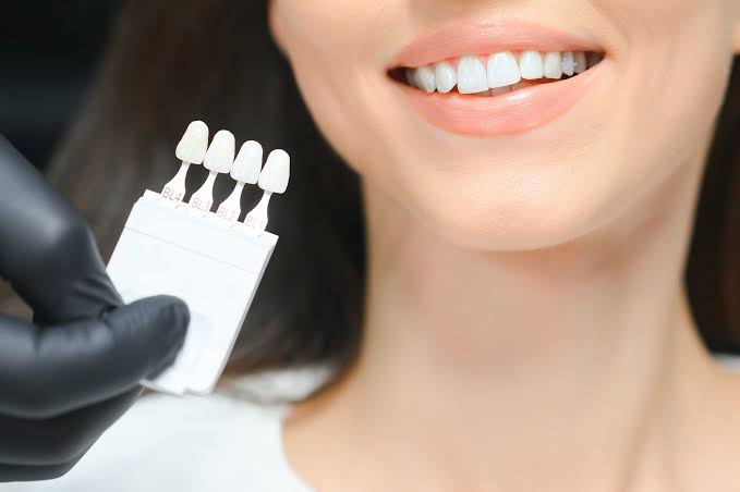 6 Tips For Maintaining A Whiter Smile After Treatment
